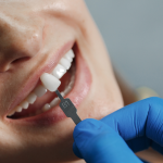 dental-crowns-long-term-benefits-for-stronger-healthier-teeth