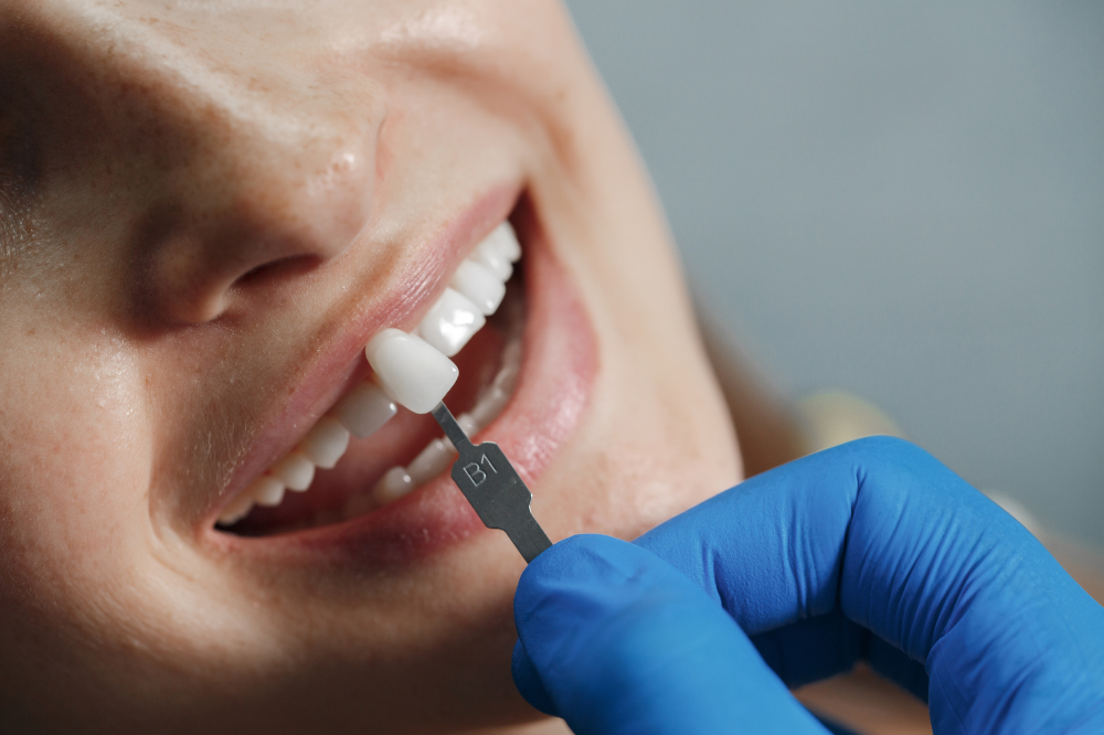 dental-crowns-long-term-benefits-for-stronger-healthier-teeth